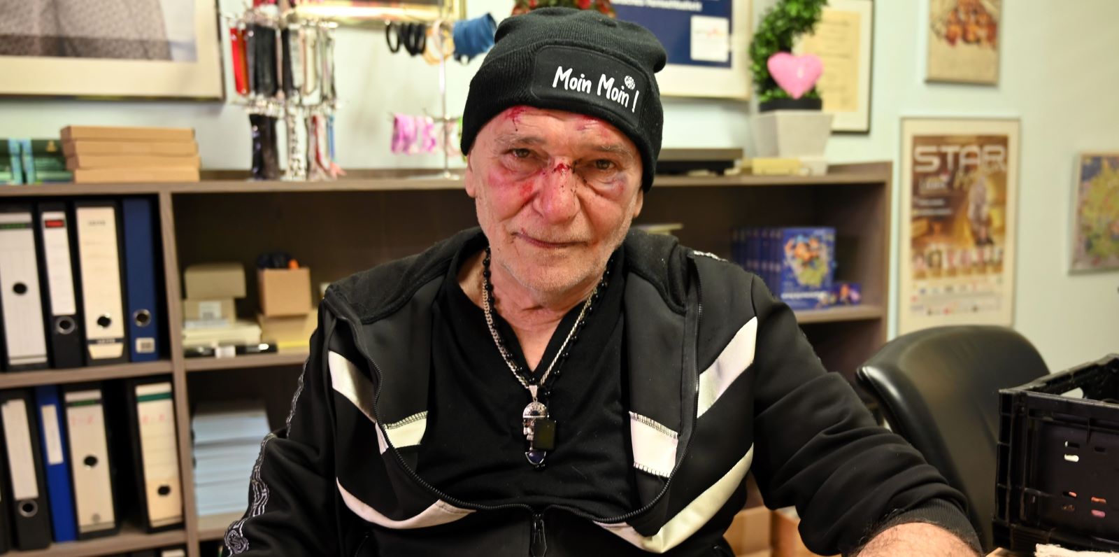 Peter Sebastian wurde bei dem Überfall im Gesicht verletzt und trug Prellungen am Körper davon. Foto: Lenthe-Medien